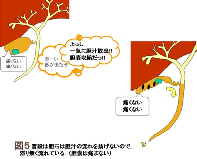 A 胆嚢は消化器です 胆嚢の仕事について説明しましょう